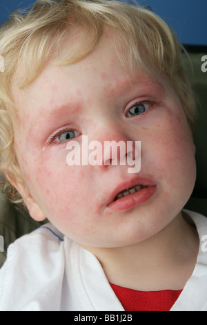 Close up di un bambino che ha appena finito di piangere e ha ancora le lacrime agli occhi e una faccia rossa Foto Stock