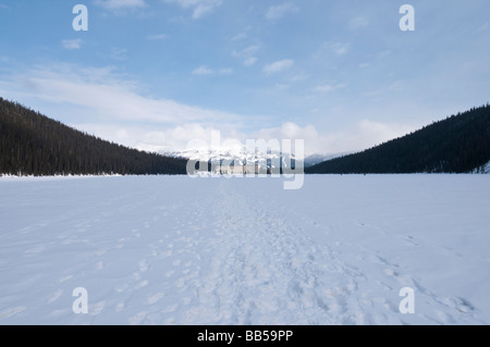Il Fairmont Chateau Lake Louise hotel circondato da montagne coperte di neve e di fronte al lago ghiacciato Foto Stock