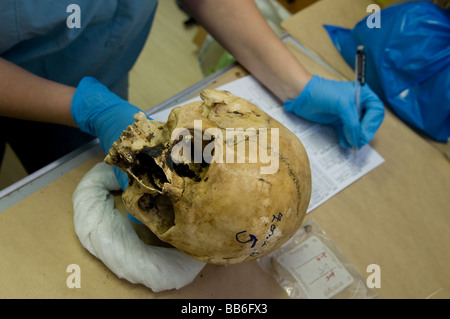 Archeologo forense che esamina un cranio umano presso la struttura mortuaria della commissione ICMP di persone scomparse dalla guerra bosniaca a Lukavac, Bosnia Foto Stock