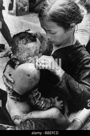 Guerra del Vietnam del Sud che a camma bruciata male bambino vietnamita catturato in scoppiare bombe napalm tra Marines americani e nord Vietnamiti Foto Stock