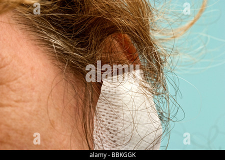 Donna di mezza età con un bendaggio bianco sul suo lobo Foto Stock