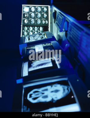 Contemporanea immagini Xray scansioni cerebrali Foto Stock