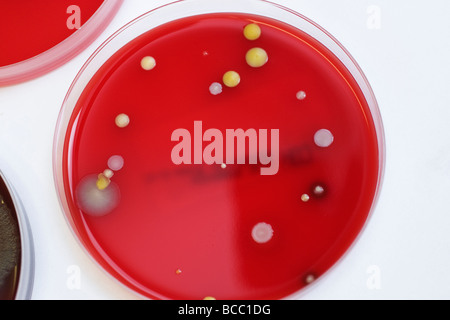 Piastre di Petri contenenti le colonie di Staphylococcus epidermidis e Staphylococcus aureus Foto Stock