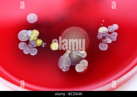 Piastre di Petri contenenti le colonie di Staphylococcus epidermidis & Diptheroids Foto Stock