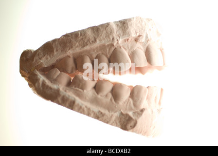 Cast dentale modello in gesso Foto Stock