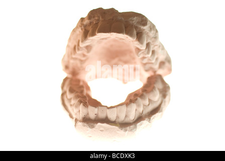 Cast dentale modello in gesso Foto Stock