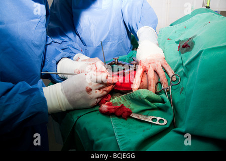 La chirurgia ortopedica su un cane arto posteriore Foto Stock