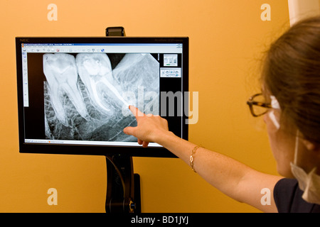 Dentista ricorda l'area dei denti, dente che necessita di lavori sui raggi X, raggi x. Foto Stock