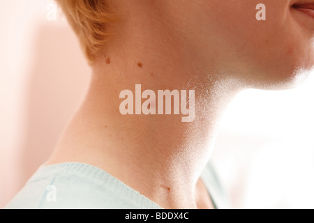 Medico esamina il paziente con birthmarks Foto Stock