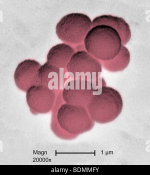 Micrografia al microscopio elettronico a scansione (SEM) di cluster di Gram-positivi, beta emolitico gruppo C Streptococcus sp. Batteri Foto Stock