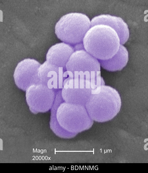 Micrografia al microscopio elettronico a scansione (SEM) di cluster di Gram-positivi, beta emolitico gruppo C Streptococcus sp. Batteri Foto Stock