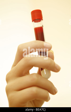 Nurse holding provetta con il sangue. Foto Stock