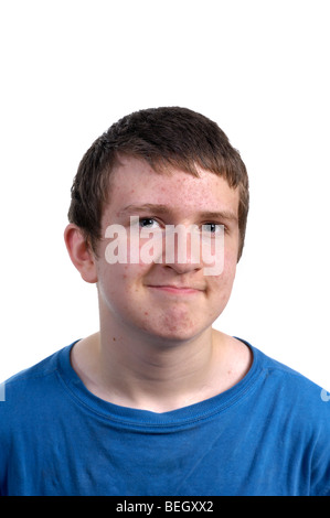 Un ragazzo di teen, con acne, guarda con un tocco di attitudine al visualizzatore. Isolato su bianco. Foto di Darrell giovani. Foto Stock