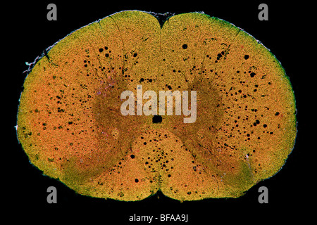 Campo oscuro fotomicrografia mammifero il midollo spinale TS Foto Stock