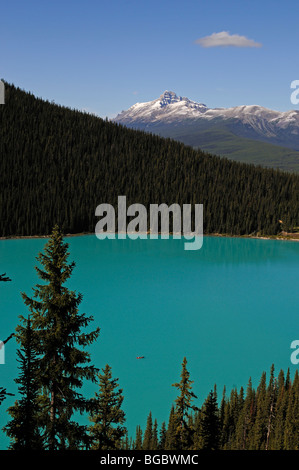 Il Lago Louise, il Parco Nazionale di Banff, Alberta, Canada Foto Stock