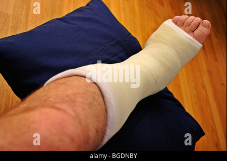Dettaglio di un uomo si è rotto una gamba in un calco in gesso, sopraelevata su un cuscino Foto Stock