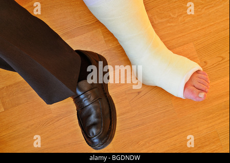 Dettaglio di un uomo di piedi con una gamba rotta in un calco in gesso Foto Stock