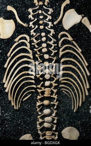 Disarticulated scheletro di un bambino che mostra la colonna vertebrale e le costole Foto Stock