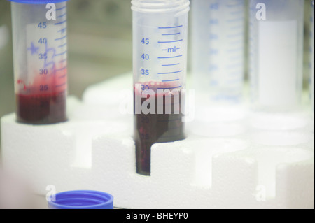 Close-up di campioni di sangue in fiale in un laboratorio Foto Stock