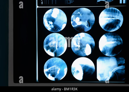 Close-up di MRI report di scansione Foto Stock