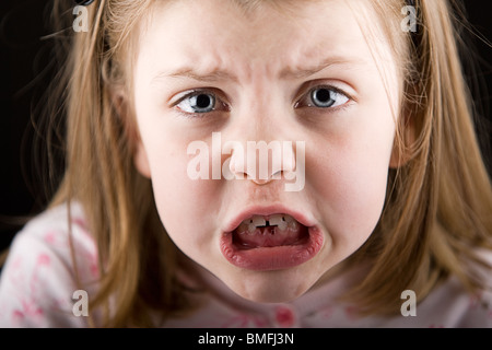 Colpo di sconvolgere un bambino con lacune nella sua denti Foto Stock