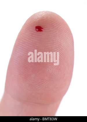 Vista macro di una goccia di sangue reale su un pollice umano. Foto Stock