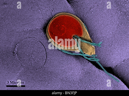 SEM della superficie ventrale di Giardia trophozoite Foto Stock