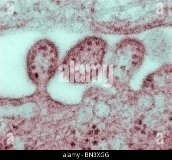 Fortemente ingrandita microscopio elettronico a trasmissione (TEM) di un certo numero di virus Lassa virioni adiacente ad alcuni detriti cellulari Foto Stock