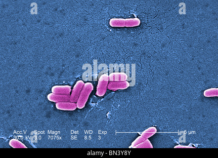 Colorati scanning electron microfotografia di Escherichia coli O157:H7 ad un ingrandimento di 7075x Foto Stock