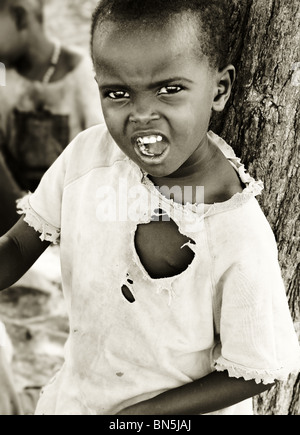 Ritratto di bambino africano esprimendo angryness. Solo uso editoriale Foto Stock