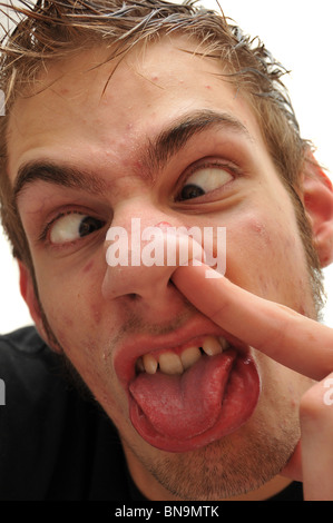 Crazy wacky brutto uomo con denti storti e acne e vene al di sopra dei suoi occhi. E come se non bastasse, egli è raccolta il suo naso. Foto Stock