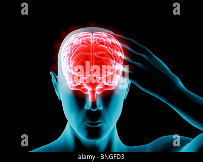 Vista ai raggi X di un uomo afferrando la sua testa nel dolore Foto Stock