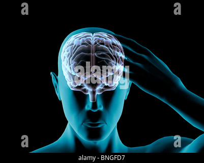 Vista ai raggi X di un uomo afferrando la sua testa nel dolore Foto Stock