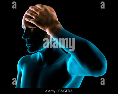 Vista ai raggi X di un uomo afferrando la sua testa nel dolore Foto Stock