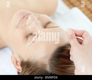 Aghi di agopuntura su una bella testa di donna Foto Stock