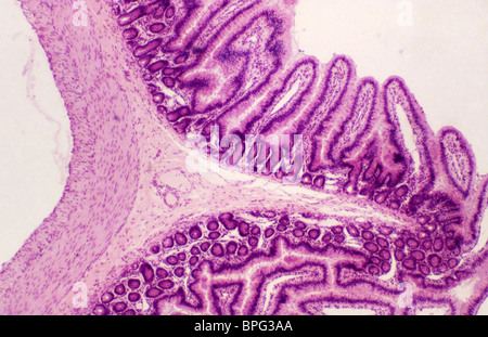 Luce di una micrografia di una sezione trasversale del digiuno che mostra chiaramente una plica, una piega permanente nella mucosa intestinale. Foto Stock