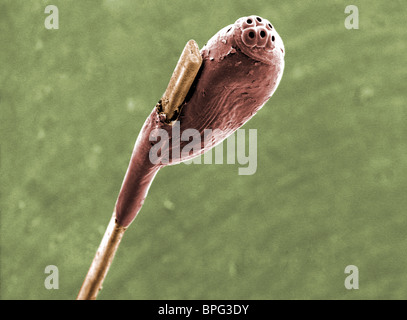 Una micrografia al microscopio elettronico a scansione (SEM) di una testa pidocchio uovo su un albero di capelli. Foto Stock