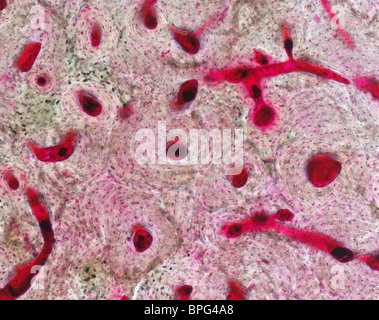 Una micrografia di luce di osso che mostra le lamelle concentriche che comprendono ciascuna osteon. Al centro di ogni osteon è un Haversi Foto Stock