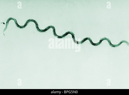 Una microfotografia di un Treponema pallidum batterio Foto Stock