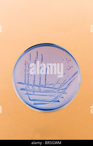 I batteri presentano striature e cresce su una piastra di agar in laboratorio Foto Stock