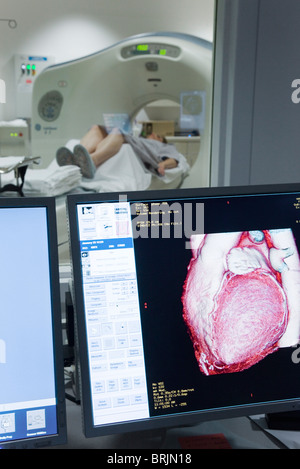 Il cuore del paziente CAT risultato di scansione mostrato sul monitor Foto Stock