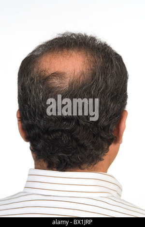 Vista posteriore di un 55 anni metà uomo orientale con una macchia calva Beirut Libano Medio Oriente Foto Stock