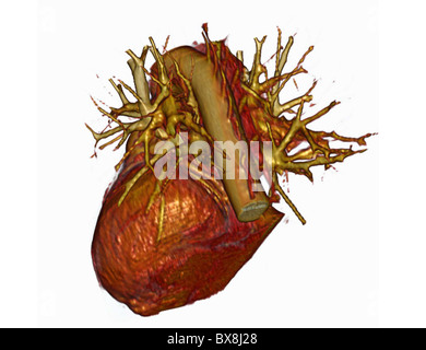 3D CT scan della testa di un uomo anziano Foto Stock