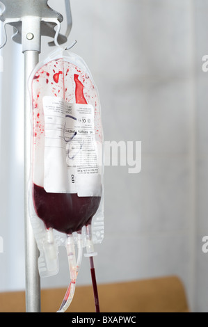 Confezione trasparente appeso sul rack è riempita con il sangue del donatore Foto Stock