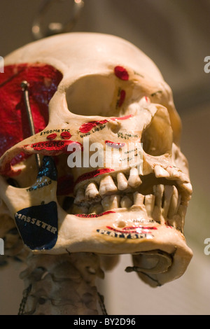 Cranio umano utilizzato per insegnare agli studenti di medicina è in mostra presso il Museo Internazionale di Scienze Chirurgiche a Chicago in Illinois. Foto Stock