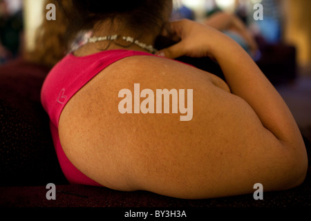 Reedley, California, Stati Uniti. Un obeso ragazza adolescente del braccio. Foto Stock