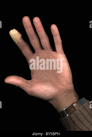 Un uomo con un gesso sul suo dito, direttamente sotto, solo a mano Foto Stock