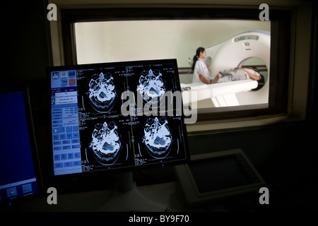 Risultati di MRI su un computer Foto Stock