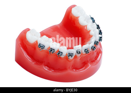 Dentiera con bretelle , la ganascia inferiore , isolato su bianco Foto Stock