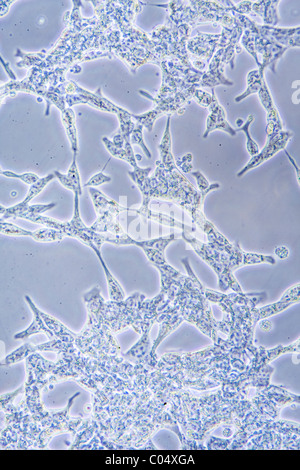 Vista al microscopio di cellule di cancro della prostata in coltura tissutale che mostra le pareti e nucleo. Foto Stock